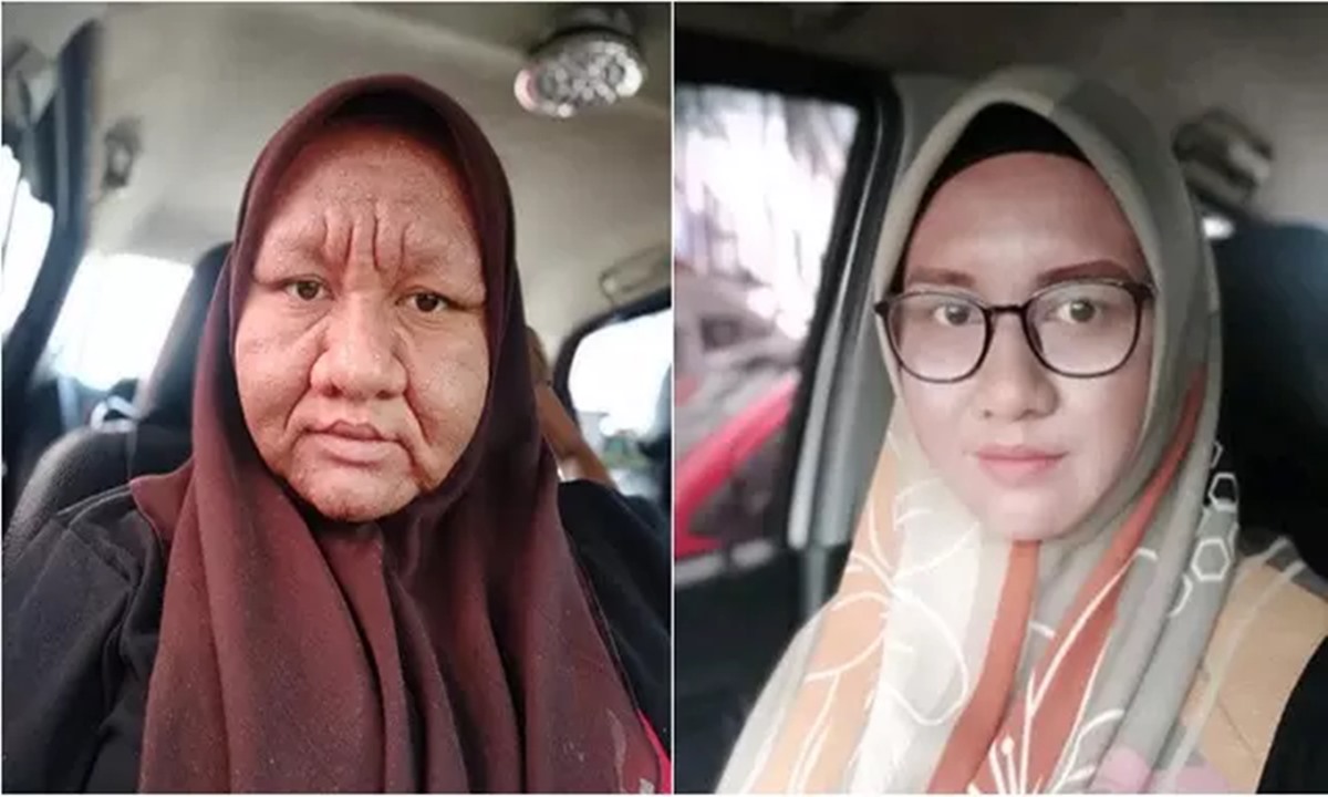 VIRAL Wanita Alami Perubahan Wajah Seperti Nenek