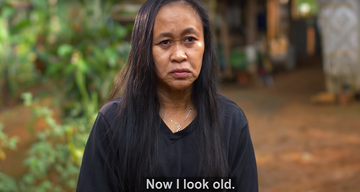 Wajah Gadis 16 Tahun Ini Terlihat Seperti Nenek-Nenek