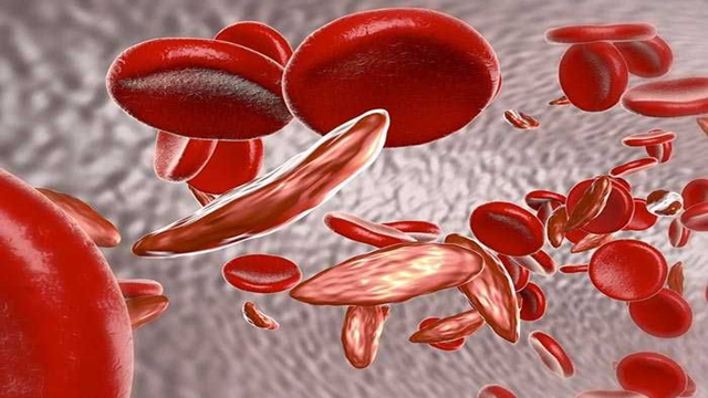 4 Penyebab Kencing Darah