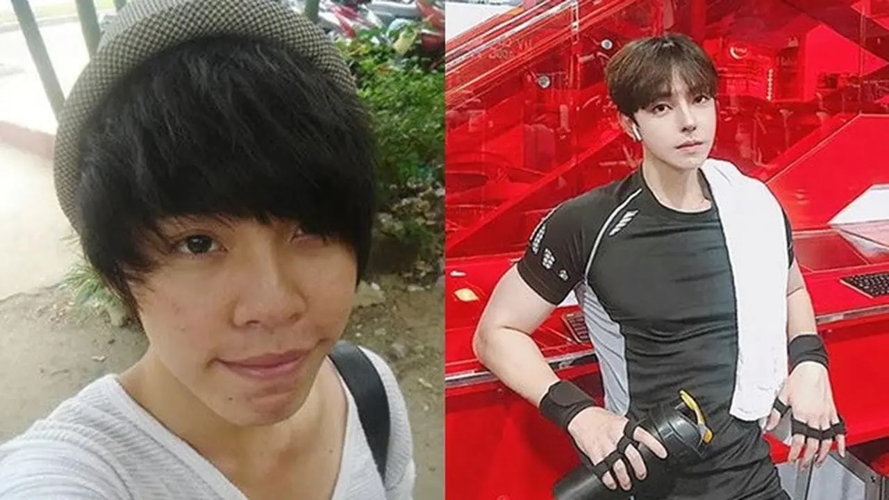 Setelah Melakukan Operasi Plastik Pria Asal Vietnam Terlihat Mirip Idol K-Pop